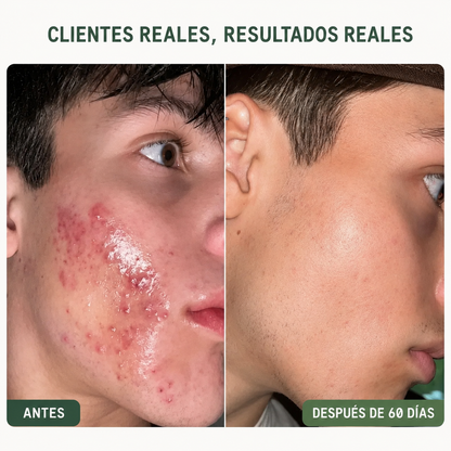 Peptidos Serum GHK-Cu